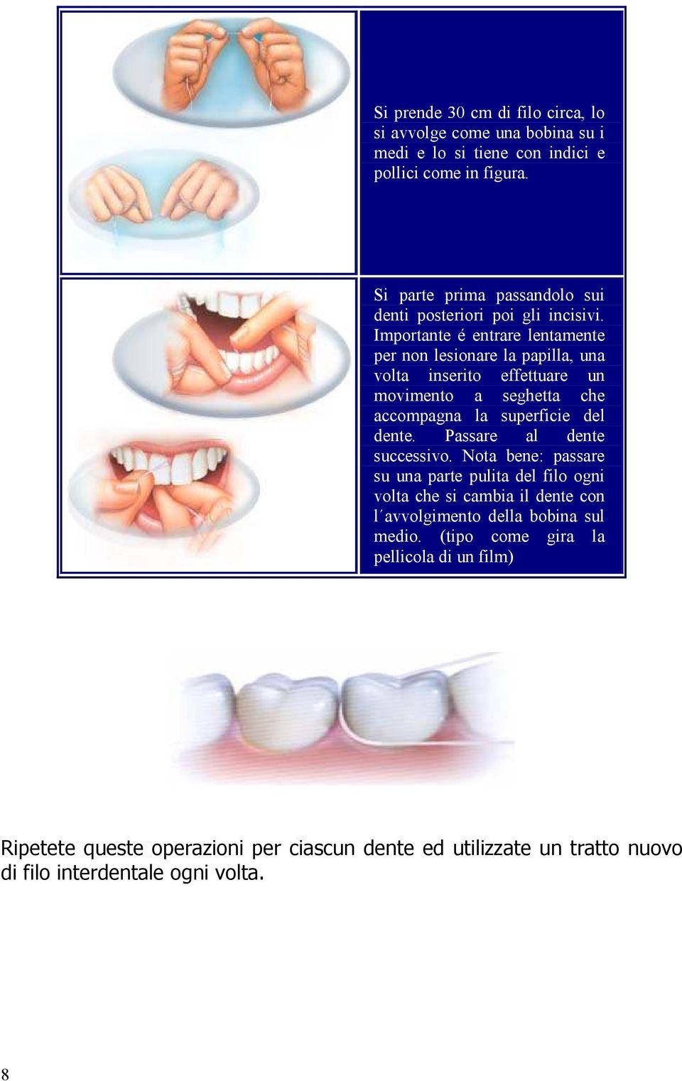 Importante é entrare lentamente per non lesionare la papilla, una volta inserito effettuare un movimento a seghetta che accompagna la superficie del dente.