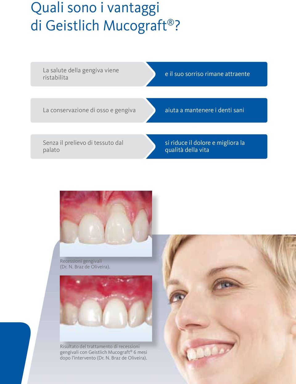 aiuta a mantenere i denti sani Senza il prelievo di tessuto dal palato si riduce il dolore e migliora la qualità