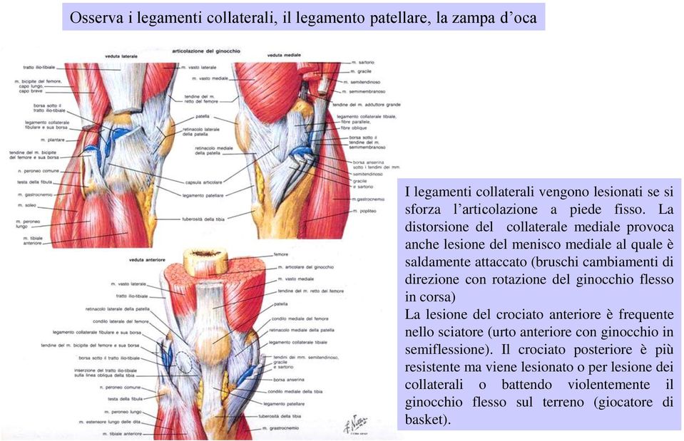 rotazione del ginocchio flesso in corsa) La lesione del crociato anteriore è frequente nello sciatore (urto anteriore con ginocchio in semiflessione).