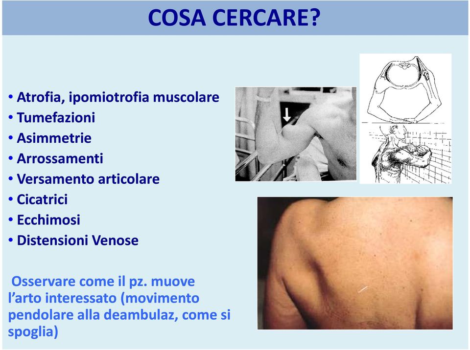 Arrossamenti Versamento articolare Cicatrici Ecchimosi