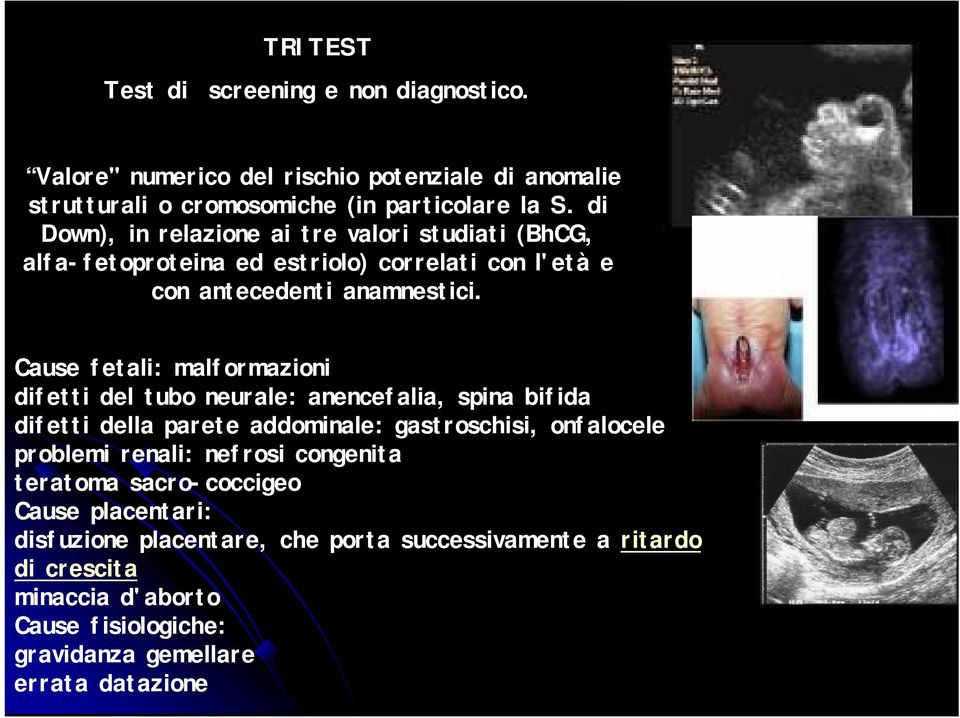 Cause fetali: malformazioni difetti del tubo neurale: anencefalia, spina bifida difetti della parete addominale: gastroschisi, onfalocele problemi renali: