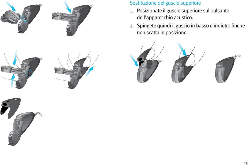 dell apparecchio acustico. 2.