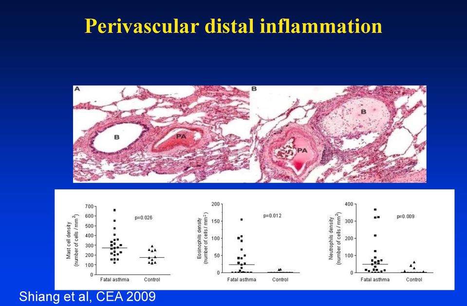 inflammation