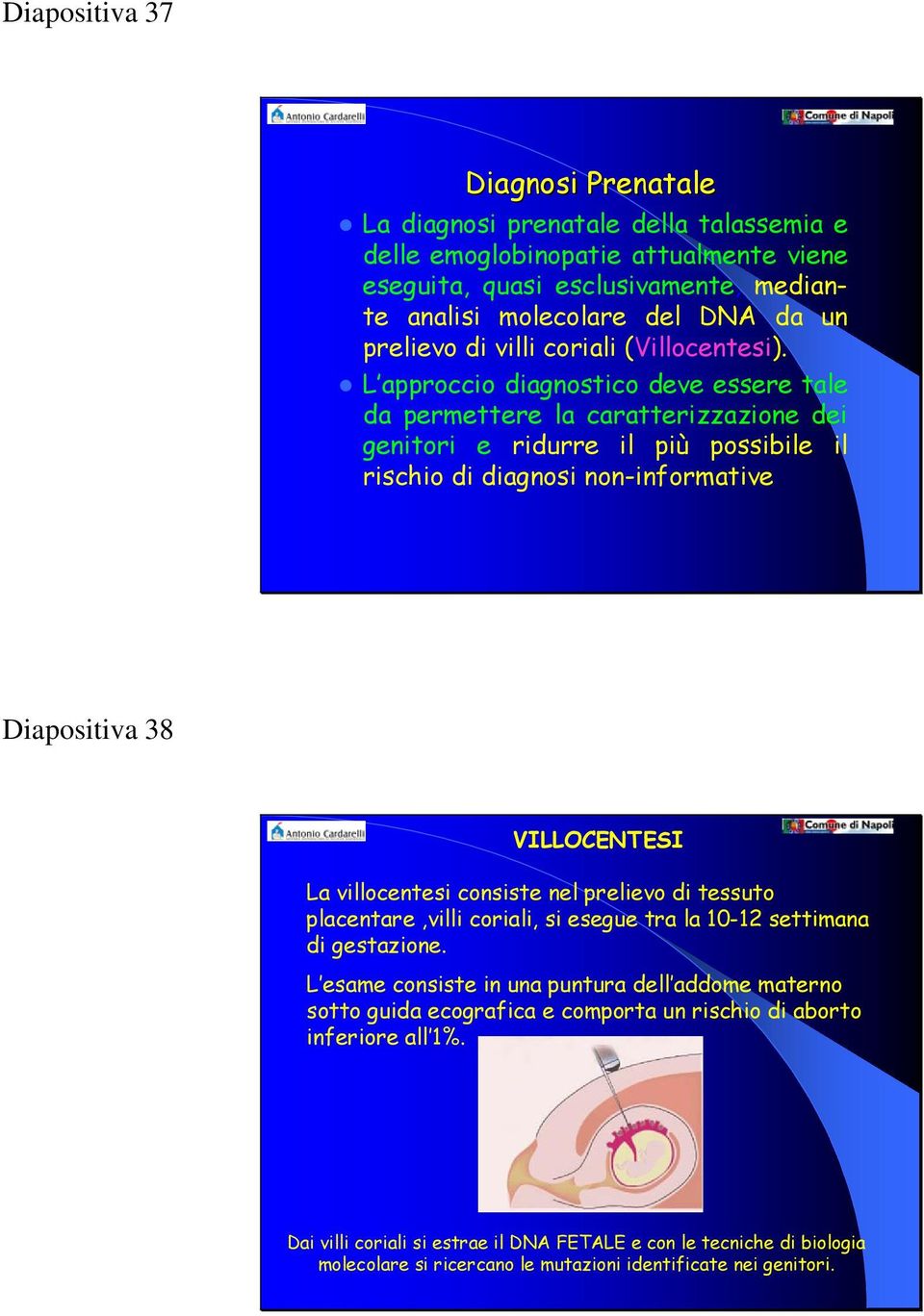 L approccio diagnostico deve essere tale da permettere la caratterizzazione dei genitori e ridurre il più possibile il rischio di diagnosi non-informative Diapositiva 38 VILLOCENTESI La villocentesi