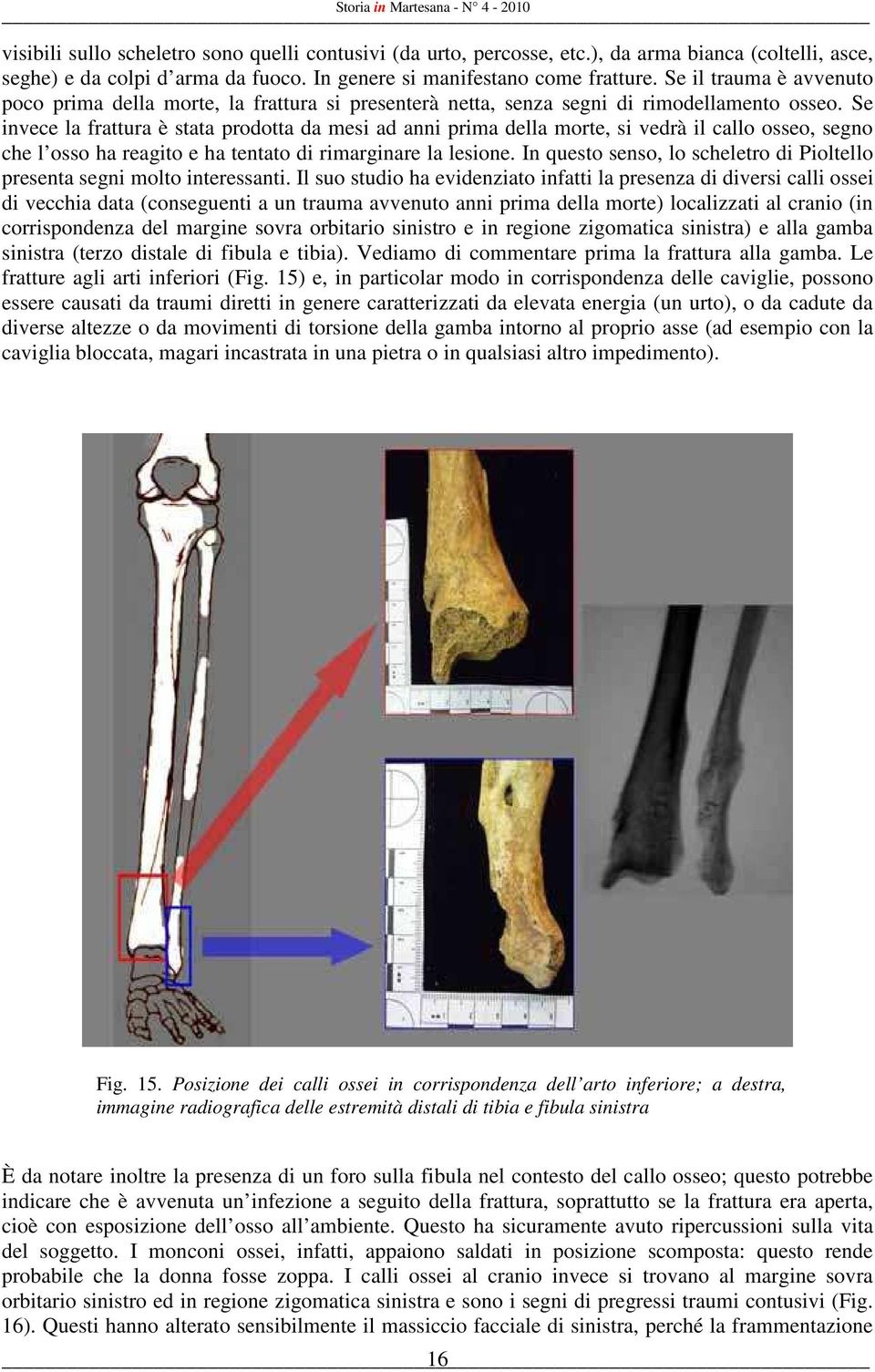 Se invece la frattura è stata prodotta da mesi ad anni prima della morte, si vedrà il callo osseo, segno che l osso ha reagito e ha tentato di rimarginare la lesione.