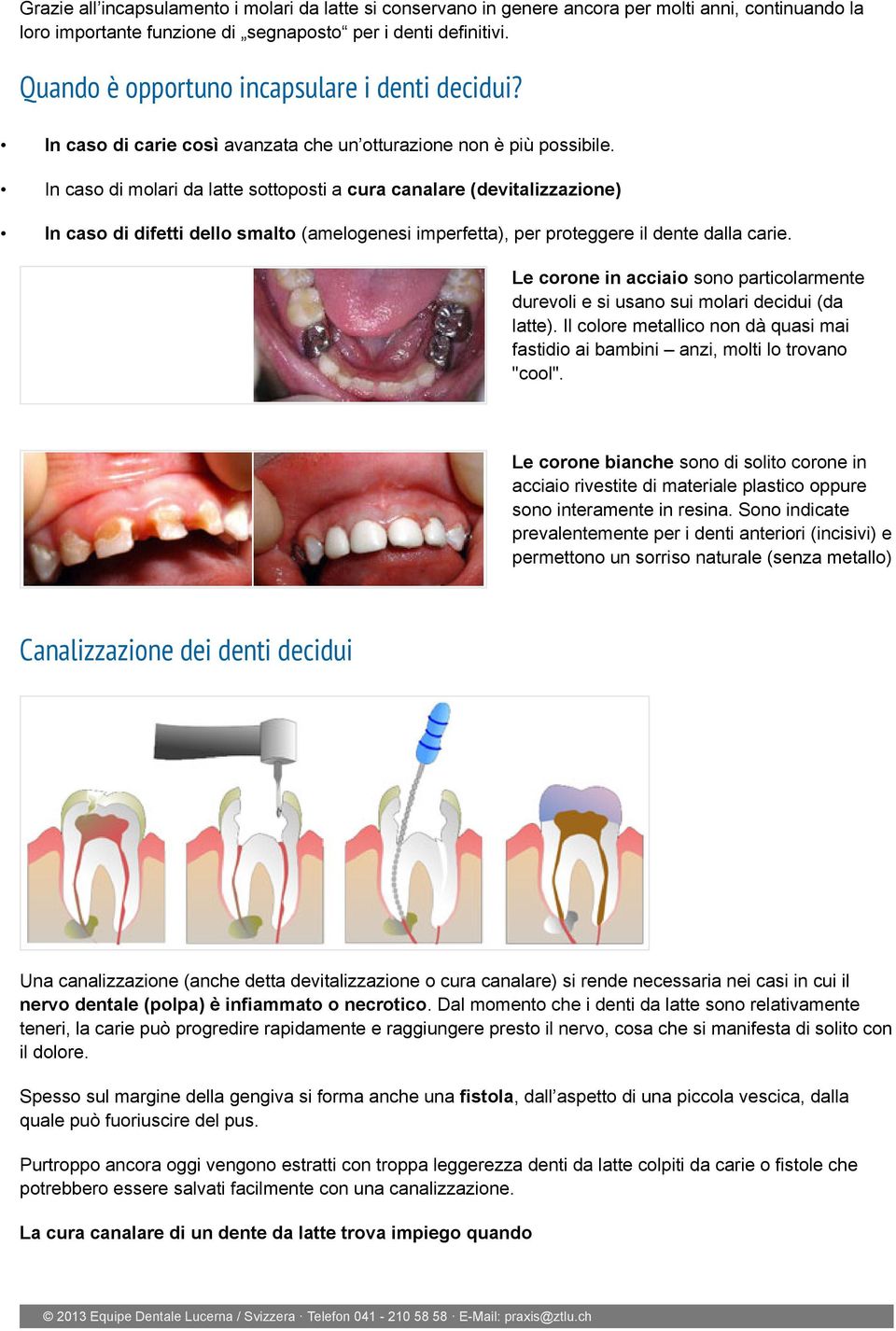 In caso di molari da latte sottoposti a cura canalare (devitalizzazione) In caso di difetti dello smalto (amelogenesi imperfetta), per proteggere il dente dalla carie.