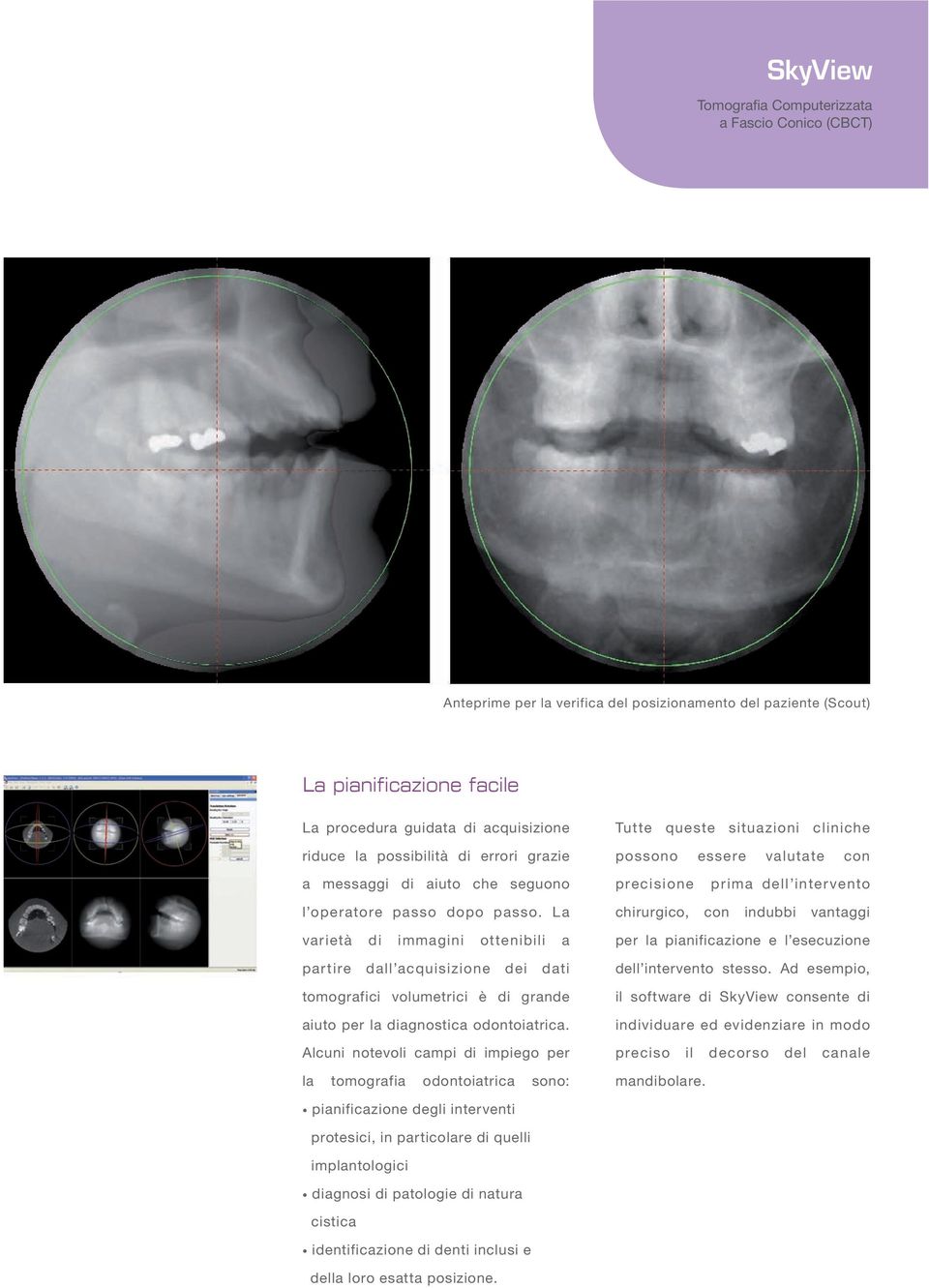 La varietà di immagini ottenibili a partire dall acquisizione dei dati tomografici volumetrici è di grande aiuto per la diagnostica odontoiatrica.