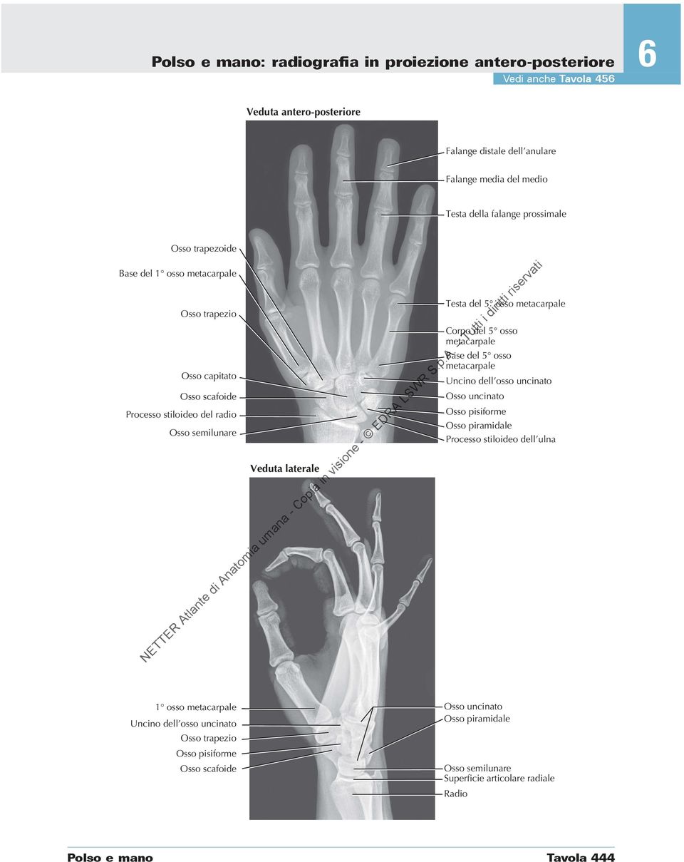 dell osso uncinato Osso scafoide Osso uncinato Processo stiloideo del radio Osso pisiforme Osso piramidale Osso semilunare Processo stiloideo dell ulna Veduta laterale 1 osso