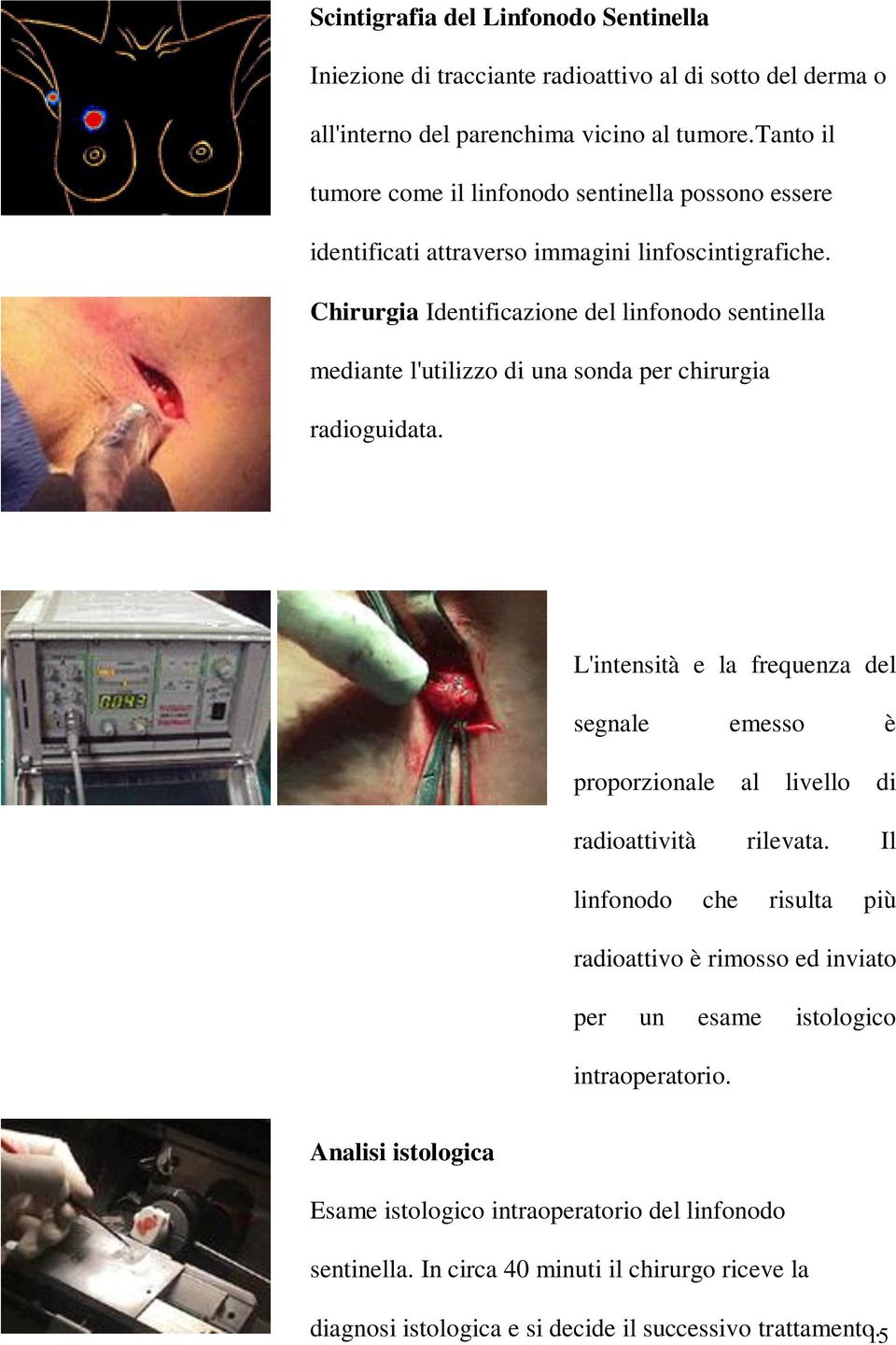 Chirurgia Identificazione del linfonodo sentinella mediante l'utilizzo di una sonda per chirurgia radioguidata.