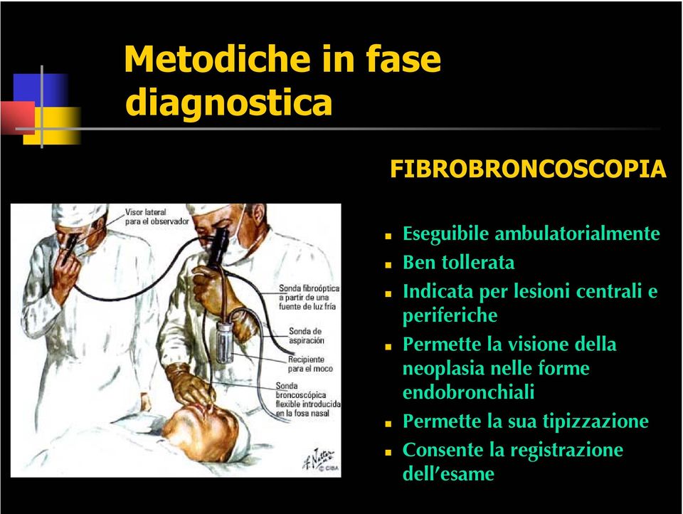 periferiche Permette la visione della neoplasia nelle forme