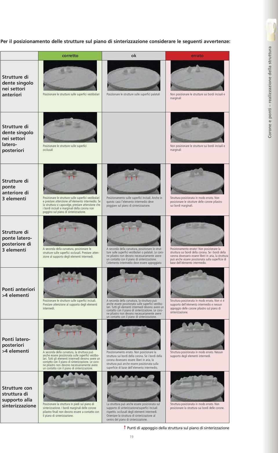 Posizionare le strutture sulle superfici occlusali Non posizionare le strutture sui bordi incisali e marginali Corone e ponti realizzazione della struttura Strutture di ponte anteriore di 3 elementi