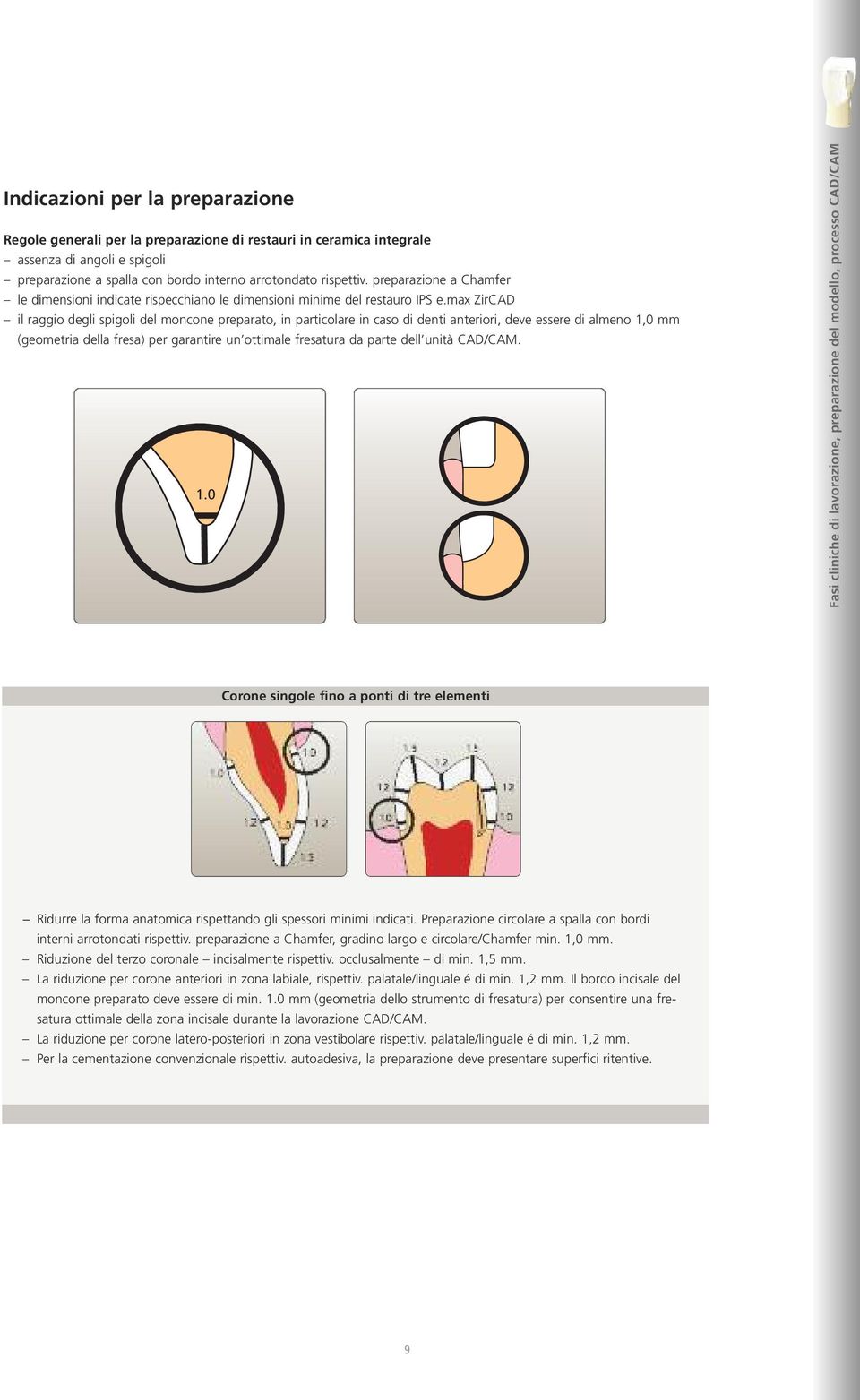 max ZirCAD il raggio degli spigoli del moncone preparato, in particolare in caso di denti anteriori, deve essere di almeno 1,0 mm (geometria della fresa) per garantire un ottimale fresatura da parte