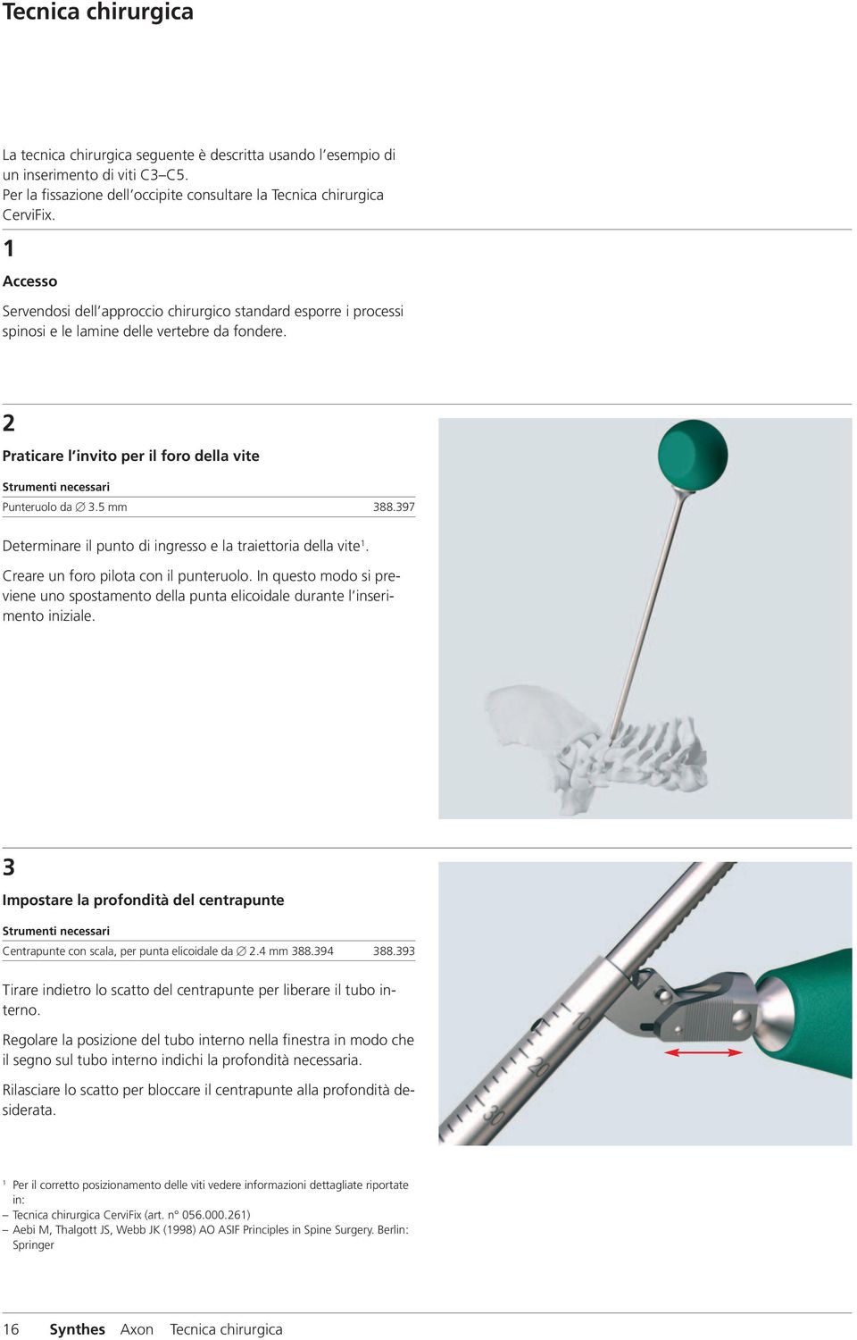 2 Praticare l invito per il foro della vite Strumenti necessari Punteruolo da 3.5 mm 388.397 Determinare il punto di ingresso e la traiettoria della vite 1. Creare un foro pilota con il punteruolo.