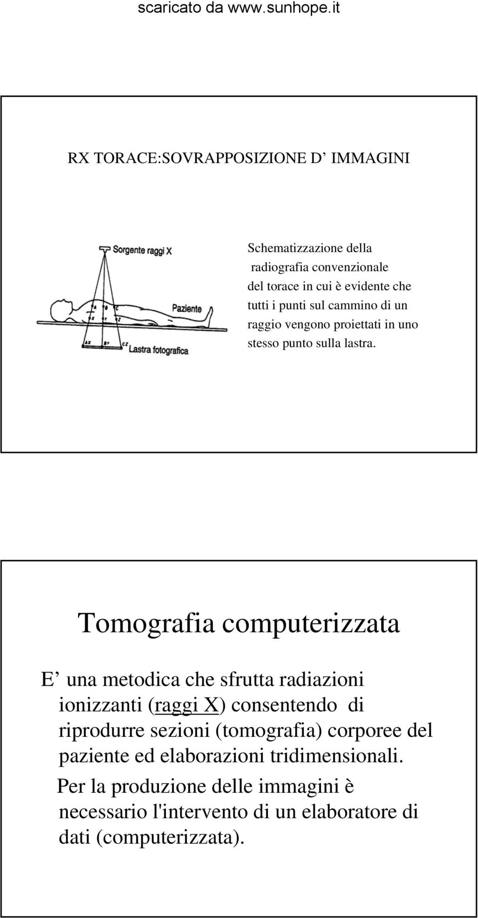 Tomografia computerizzata E una metodica che sfrutta radiazioni ionizzanti (raggi X) consentendo di riprodurre sezioni