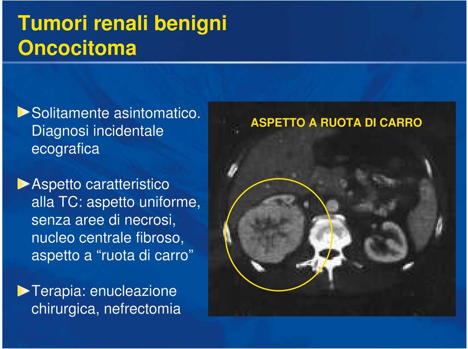 caratteristico alla TC: aspetto uniforme, senza aree di necrosi,