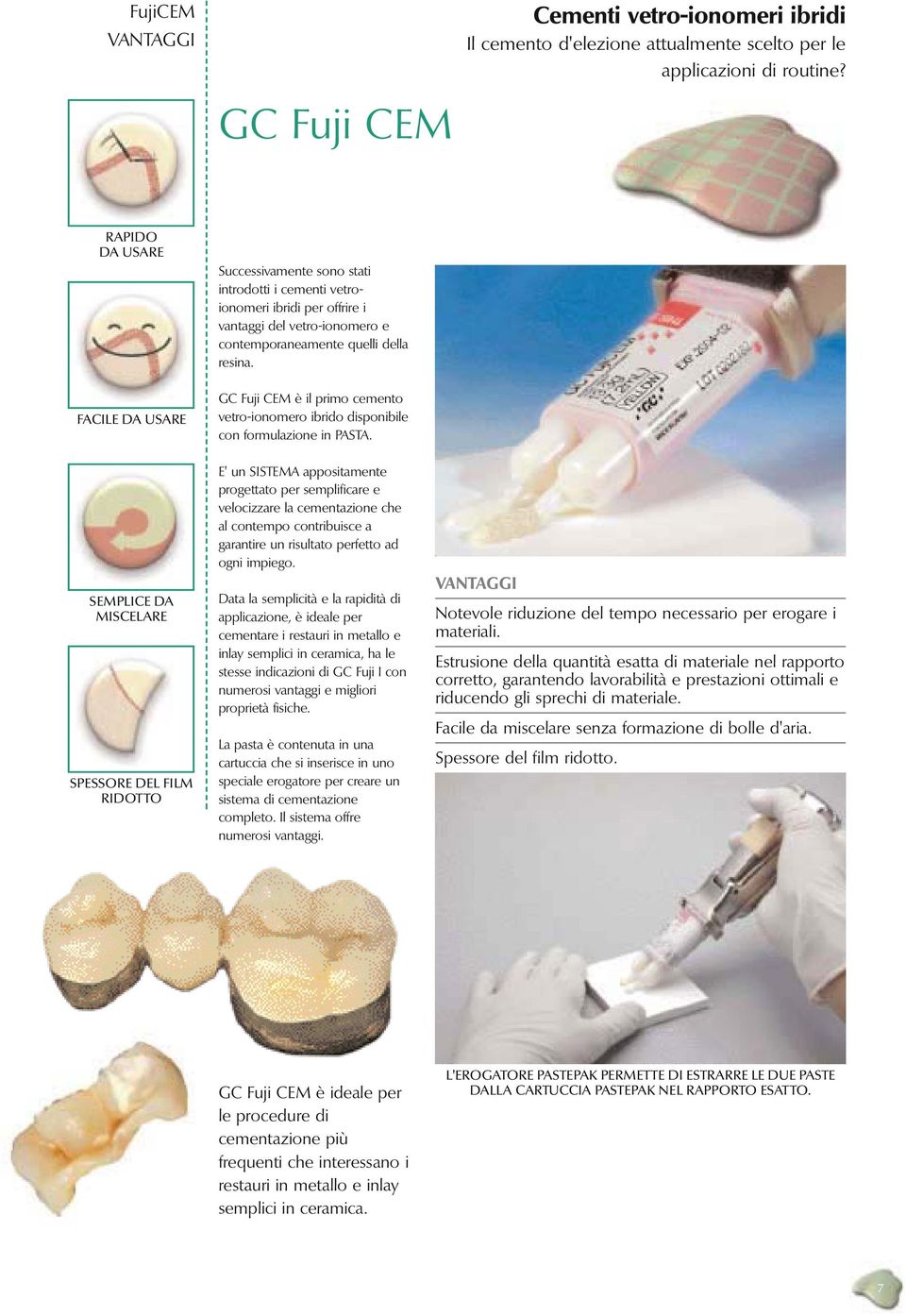 FACILE DA USARE GC Fuji CEM è il primo cemento vetro-ionomero ibrido disponibile con formulazione in PASTA.