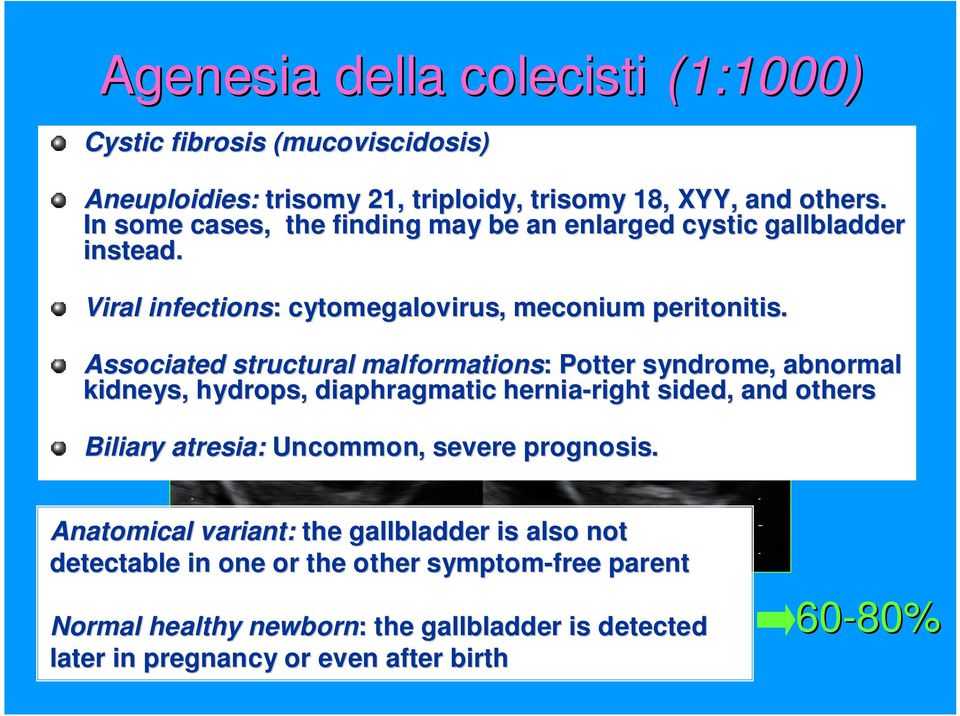 Associated structural malformations: : Potter syndrome, abnormal kidneys, hydrops, diaphragmatic hernia-right right sided,, and others Biliary atresia: