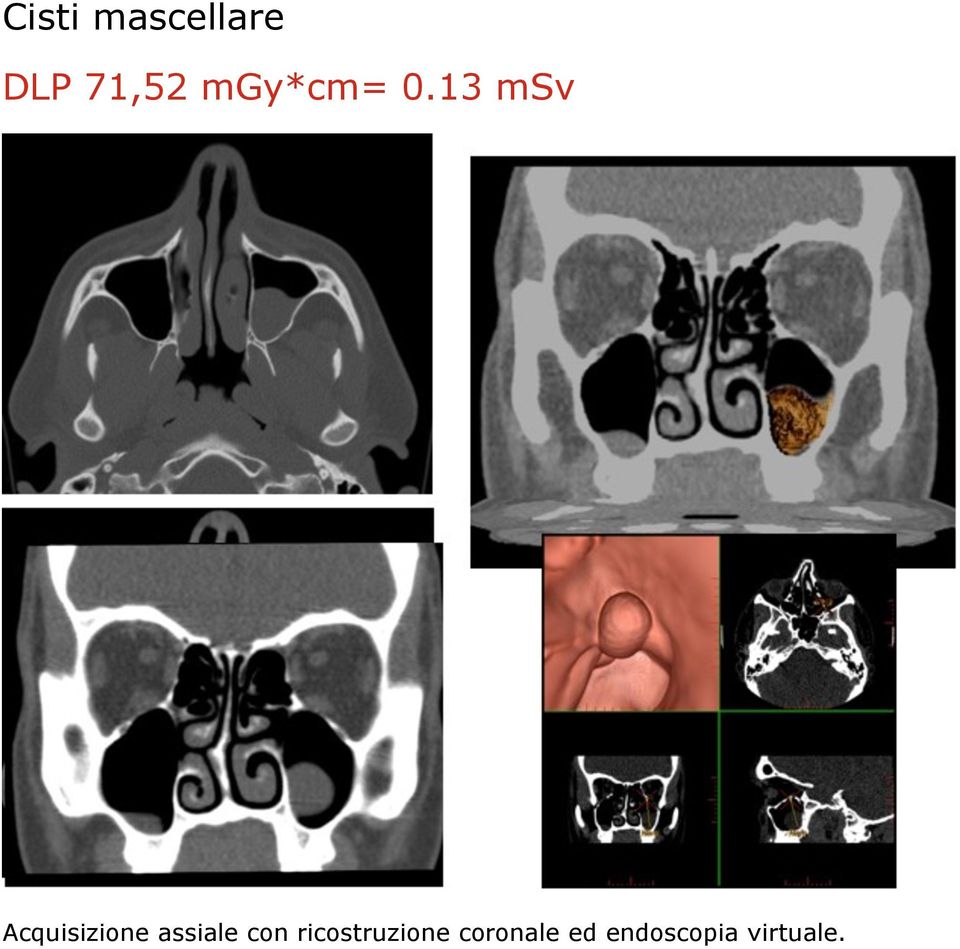 13 msv Acquisizione assiale