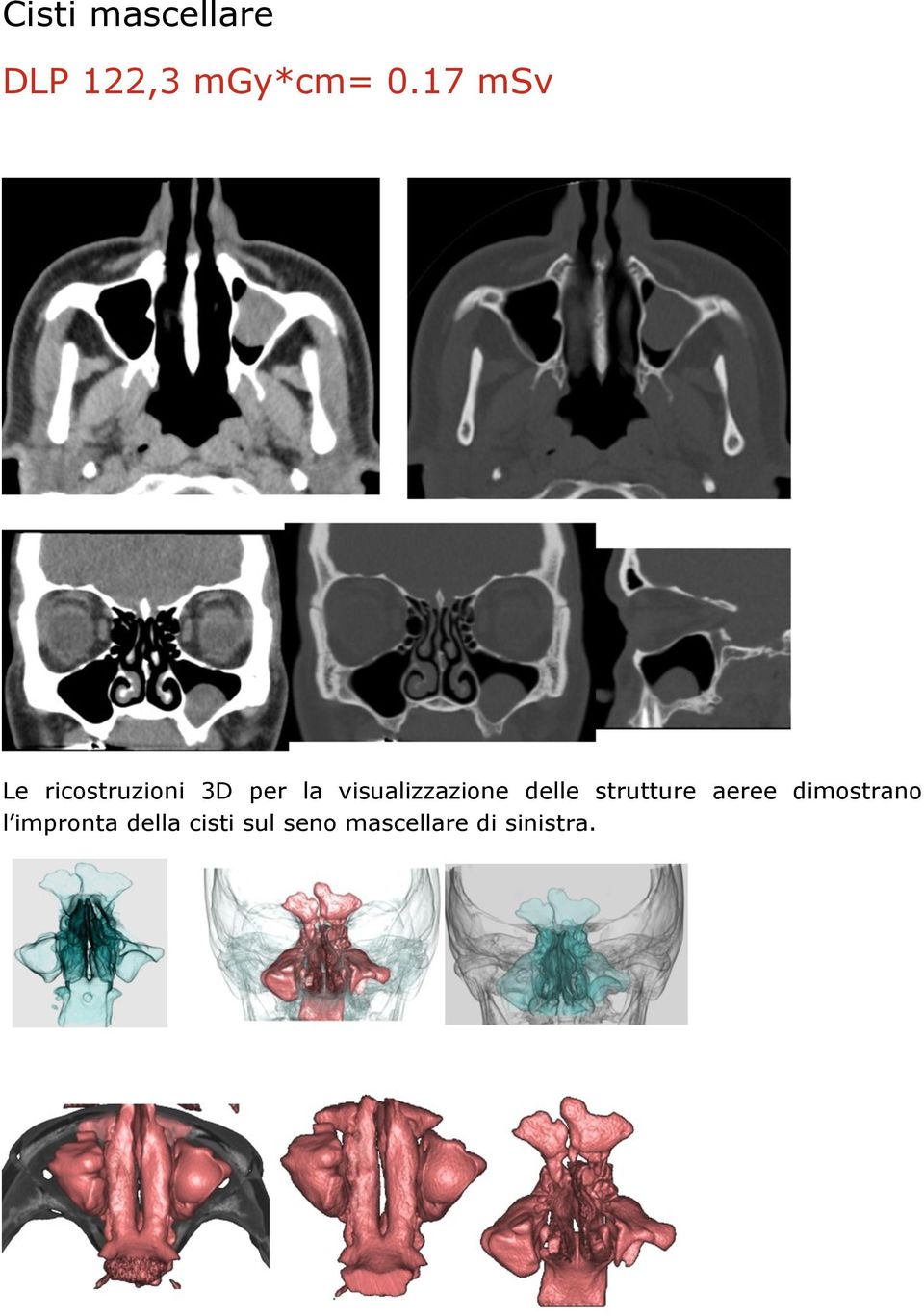 visualizzazione delle strutture aeree