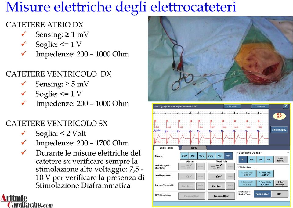 VENTRICOLO SX ü Soglia: < 2 Volt ü Impedenze: 200 1700 Ohm ü Durante le misure elettriche del catetere sx