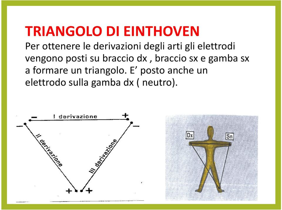 dx, braccio sxe gamba sx a formare un triangolo.