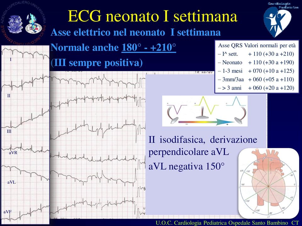 + 110 (+30 a +210) Neonato + 110 (+30 a +190) 1-3 mesi + 070 (+10 a +125) 3mm/3aa + 060