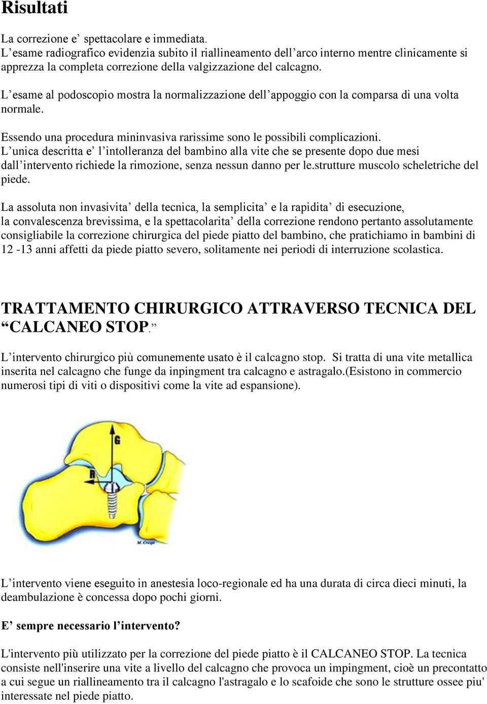 L esame al podoscopio mostra la normalizzazione dell appoggio con la comparsa di una volta normale. Essendo una procedura mininvasiva rarissime sono le possibili complicazioni.