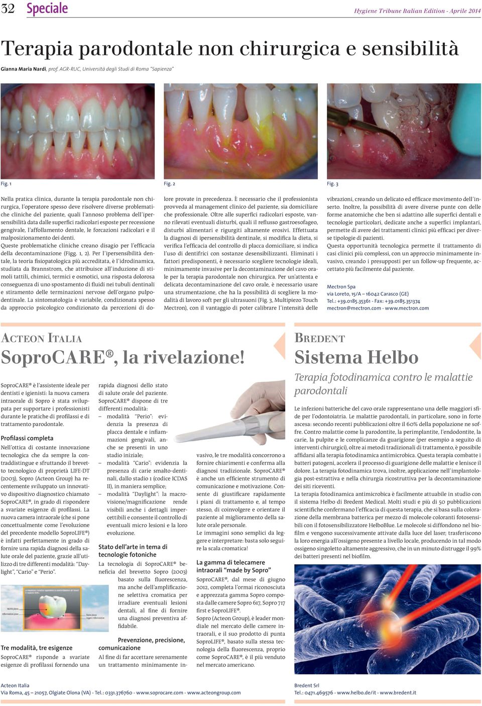 data dalle superici radicolari esposte per recessione gengivale, l affollamento dentale, le forcazioni radicolari e il malposizionamento dei denti.