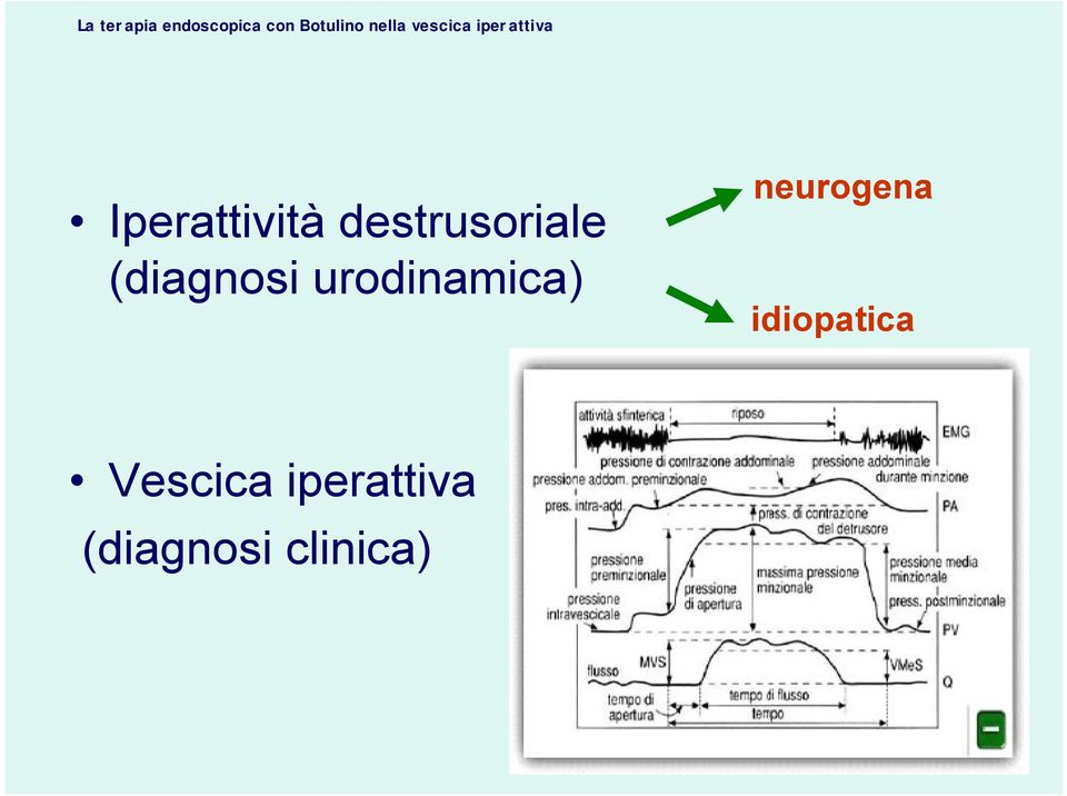neurogena idiopatica
