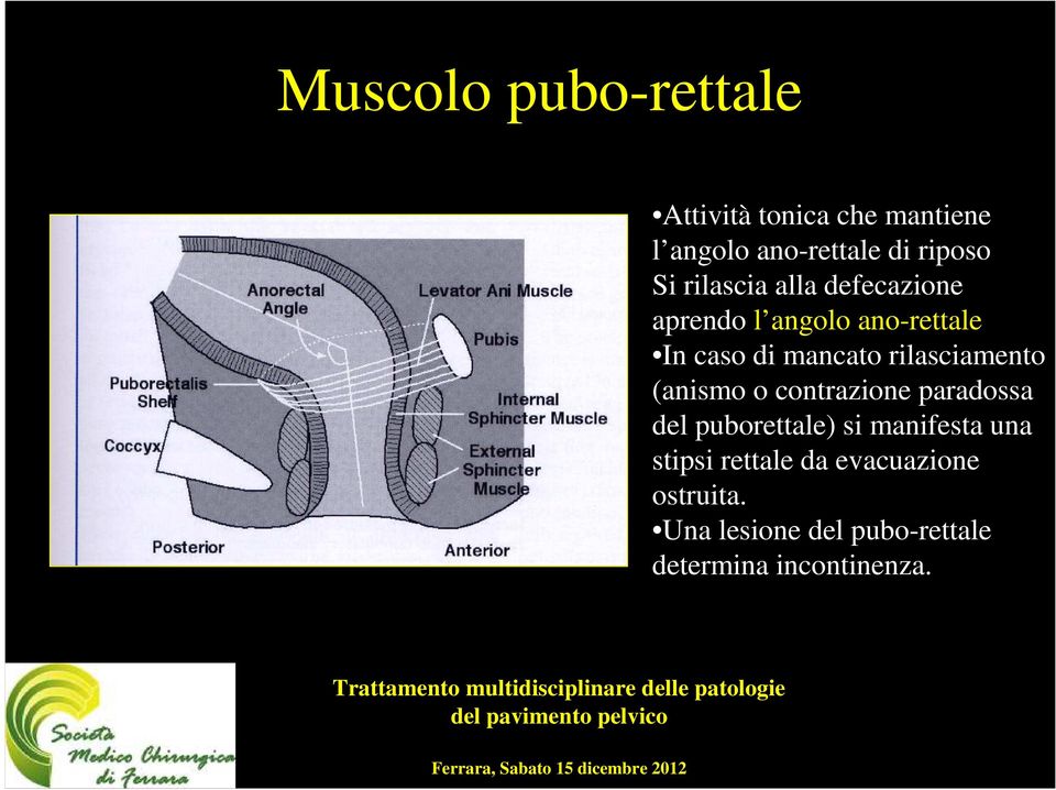 rilasciamento (anismo o contrazione paradossa del puborettale) si manifesta una