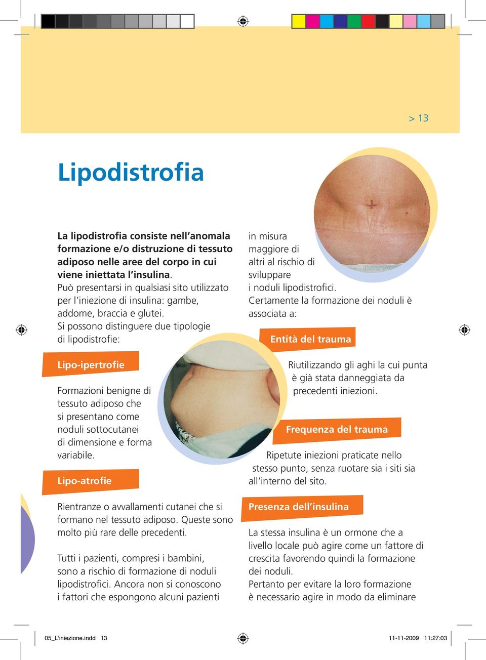 Si possono distinguere due tipologie di lipodistrofie: Lipo-ipertrofie Formazioni benigne di tessuto adiposo che si presentano come noduli sottocutanei di dimensione e forma variabile.