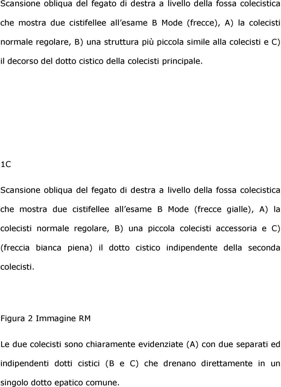 1C Scansione obliqua del fegato di destra a livello della fossa colecistica che mostra due cistifellee all esame B Mode (frecce gialle), A) la colecisti normale regolare, B) una piccola