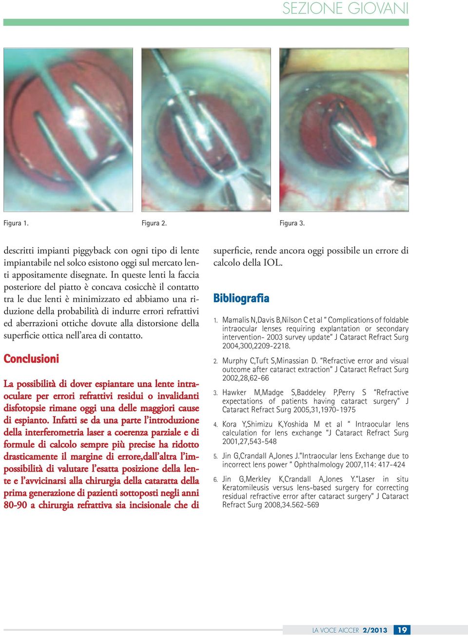 ottiche dovute alla distorsione della superficie ottica nell area di contatto.