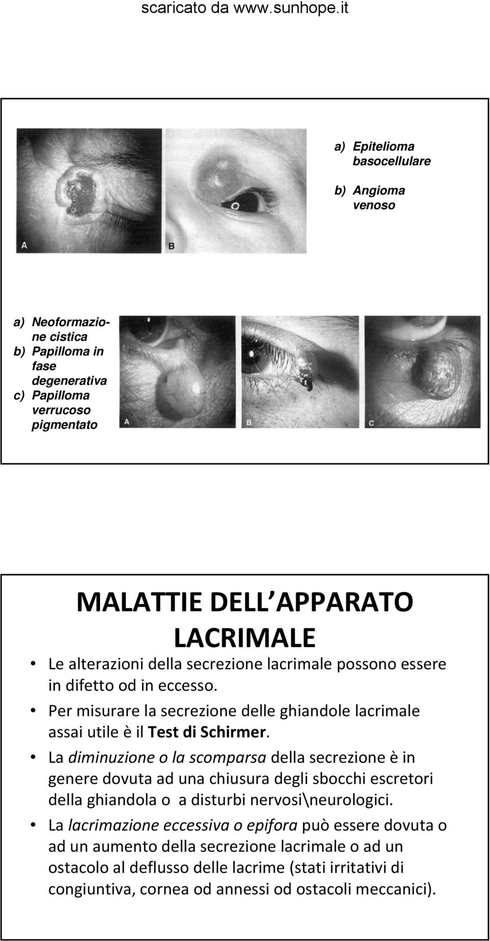 La diminuzione o la scomparsa della secrezione èin genere dovuta ad una chiusura degli sbocchi escretori della ghiandola o a disturbi nervosi\neurologici.