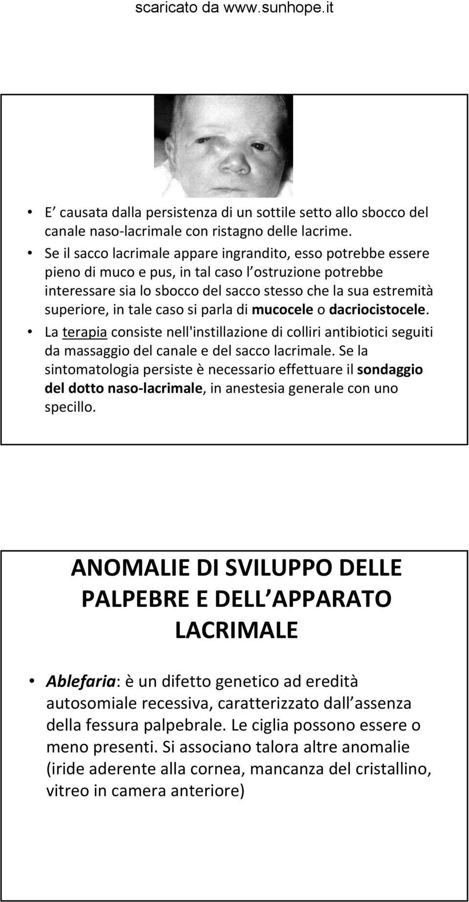 caso si parla di mucocele o dacriocistocele. La terapia consiste nell'instillazione di colliri antibiotici seguiti da massaggio del canale e del sacco lacrimale.