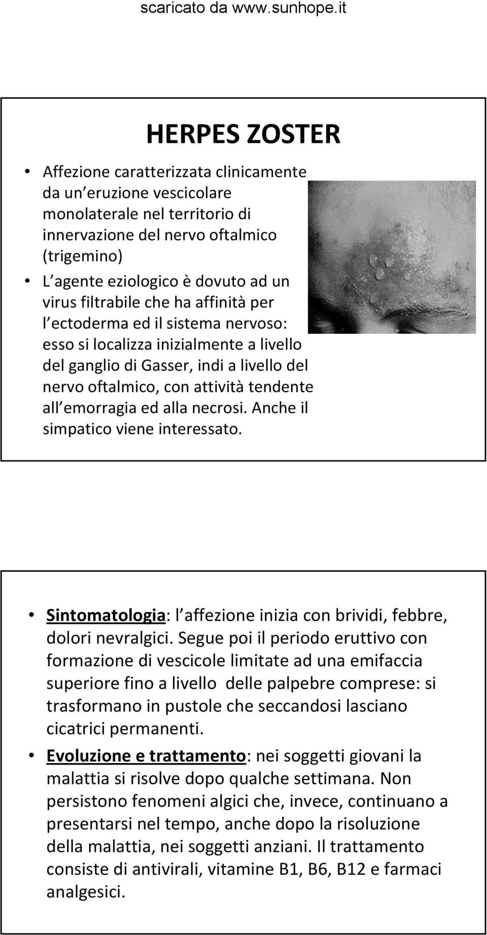 emorragia ed alla necrosi. Anche il simpatico viene interessato. Sintomatologia: l affezione inizia con brividi, febbre, dolori nevralgici.