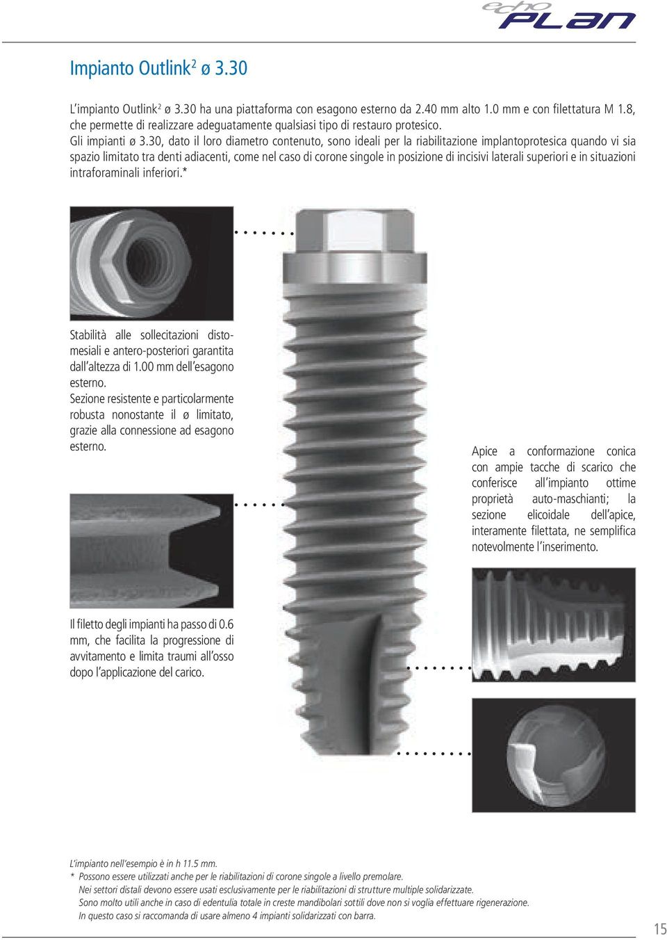30, dato il loro diametro contenuto, sono ideali per la riabilitazione implantoprotesica quando vi sia spazio limitato tra denti adiacenti, come nel caso di corone singole in posizione di incisivi