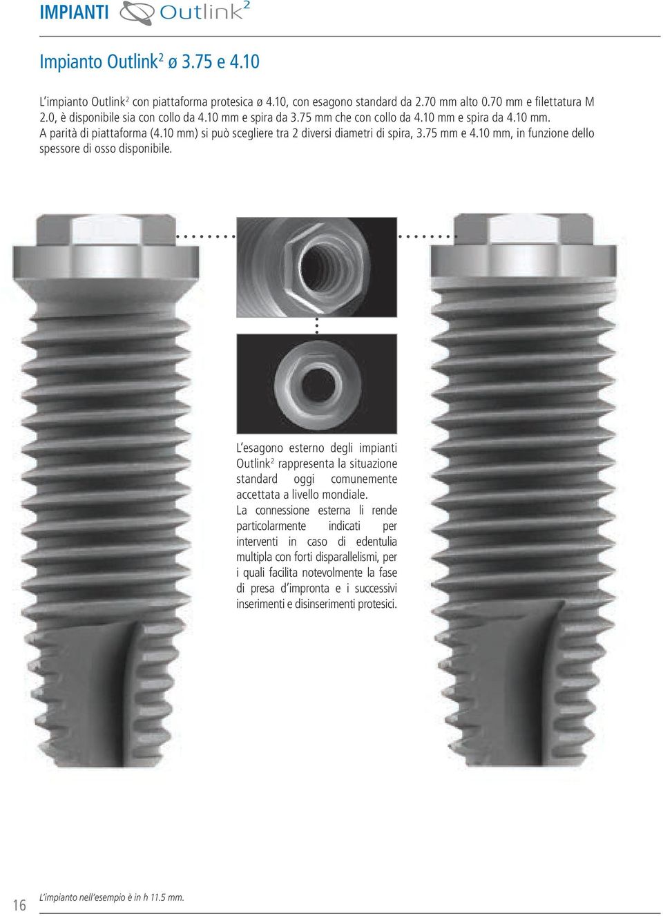 10 mm, in funzione dello spessore di osso disponibile. L esagono esterno degli impianti Outlink 2 rappresenta la situazione standard oggi comunemente accettata a livello mondiale.