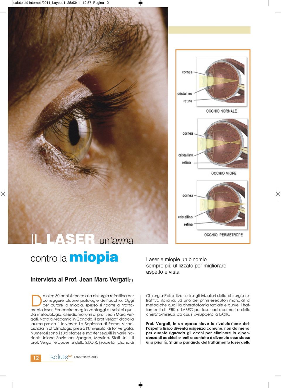 Oggi per curare la miopia, spesso si ricorre al trattamento laser. Per capire meglio vantaggi e rischi di questa metodologia, chiediamo lumi al prof Jean Marc Vergati.