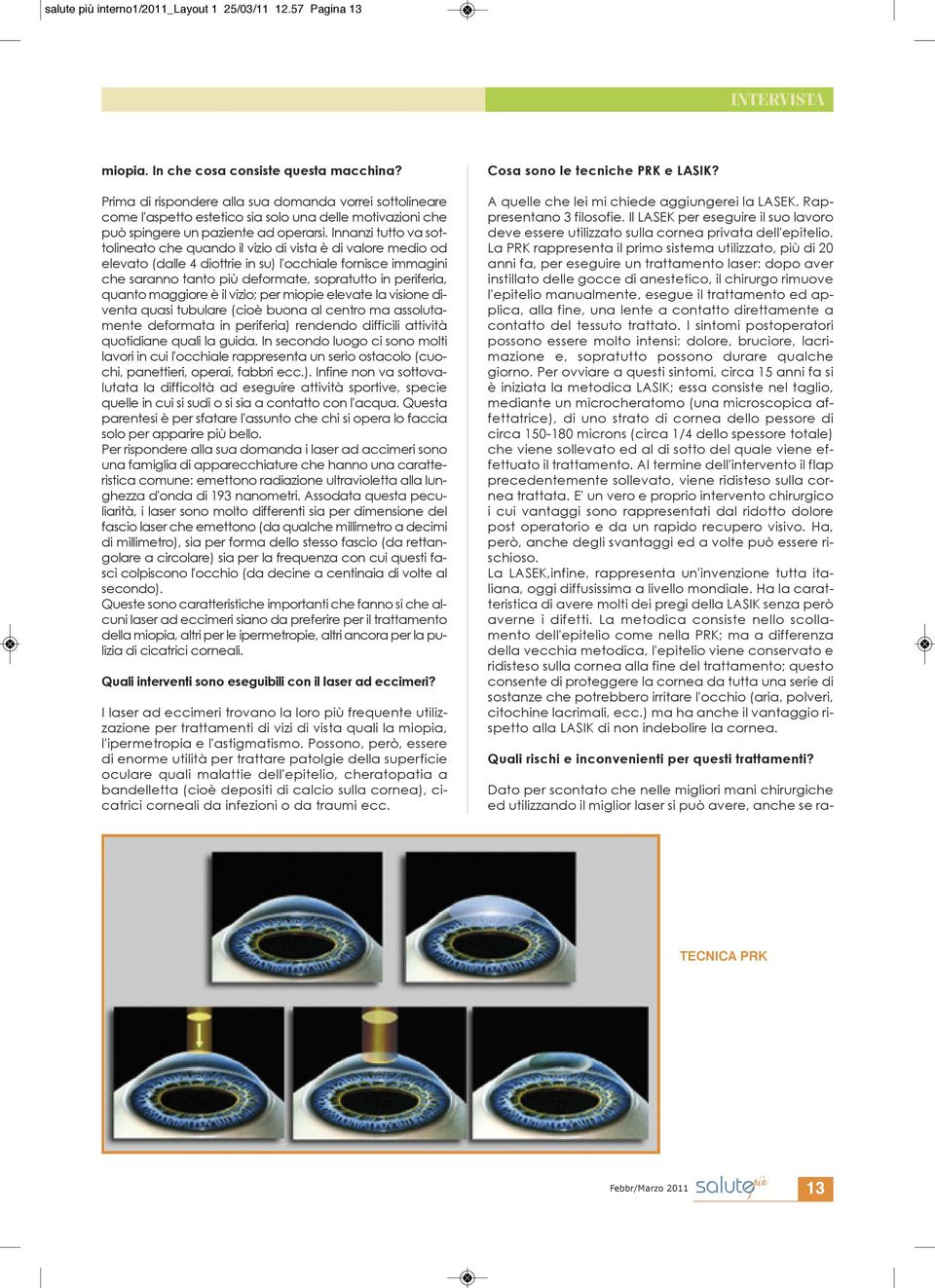 Innanzi tutto va sottolineato che quando il vizio di vista è di valore medio od elevato (dalle 4 diottrie in su) l'occhiale fornisce immagini che saranno tanto più deformate, sopratutto in periferia,