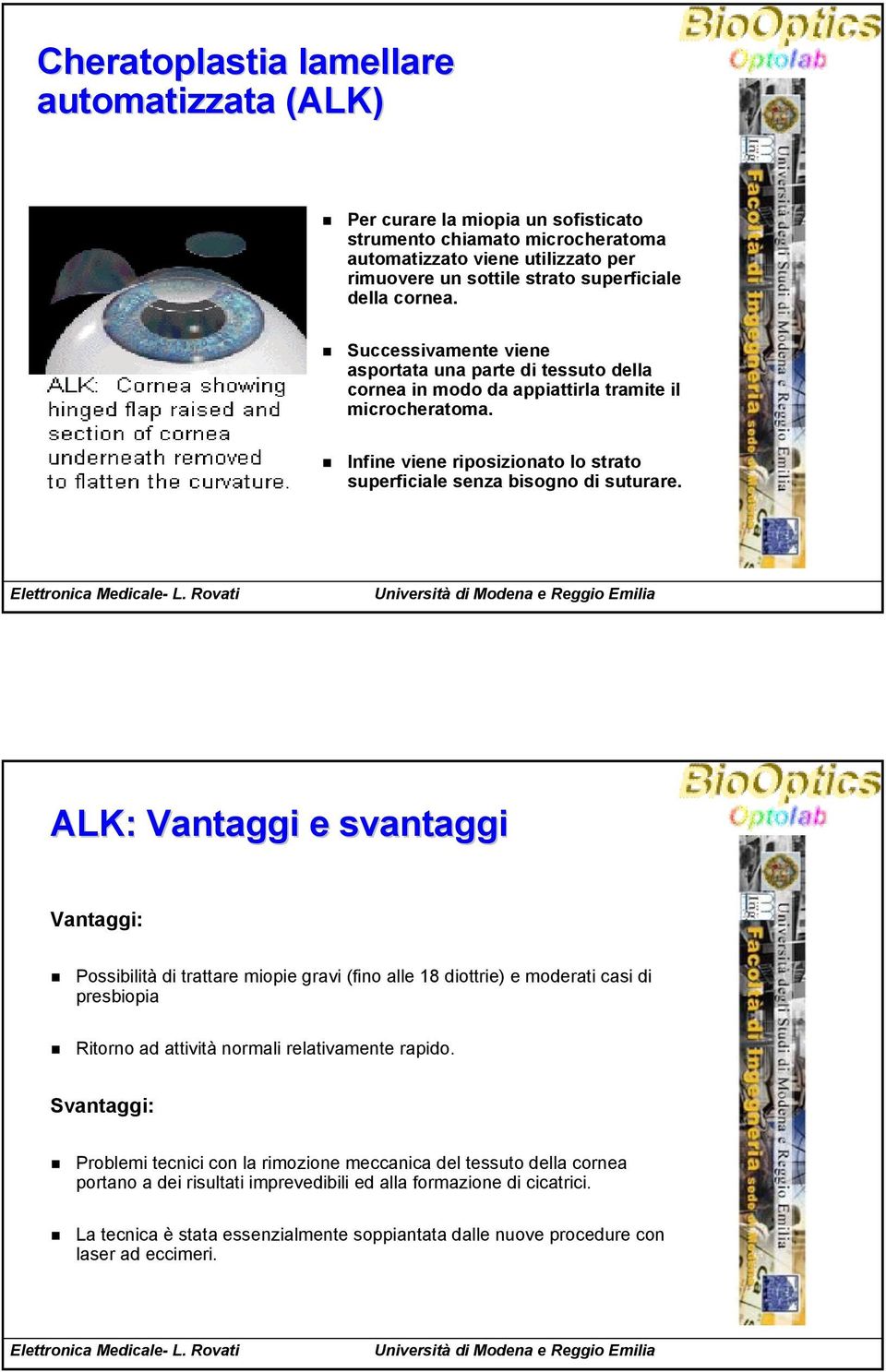 ALK: Vantaggi e svantaggi Vantaggi: Possibilità di trattare miopie gravi (fino alle 18 diottrie) e moderati casi di presbiopia Ritorno ad attività normali relativamente rapido.