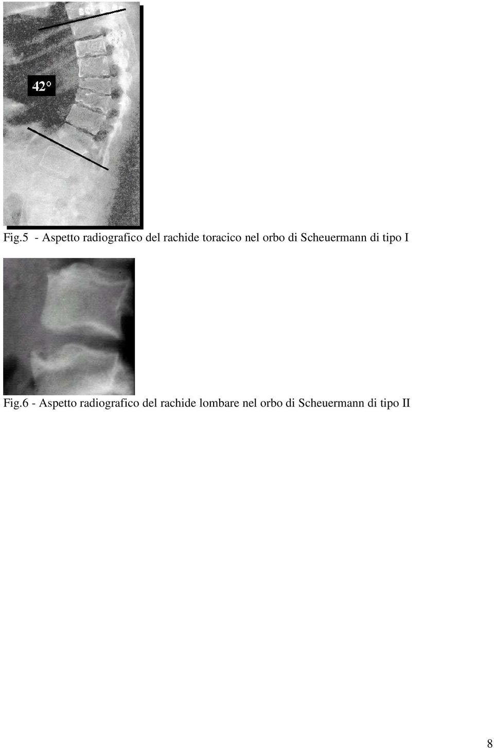 Fig.6 - Aspetto radiografico del rachide