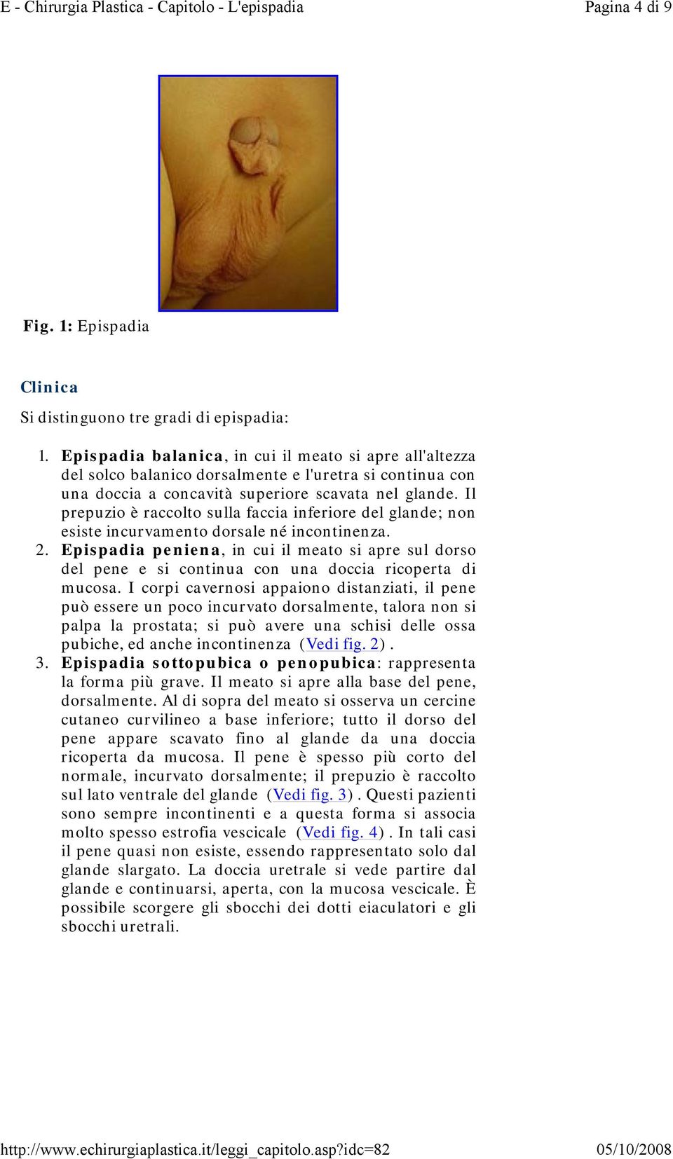 Il prepuzio è raccolto sulla faccia inferiore del glande; non esiste incurvamento dorsale né incontinenza. 2.