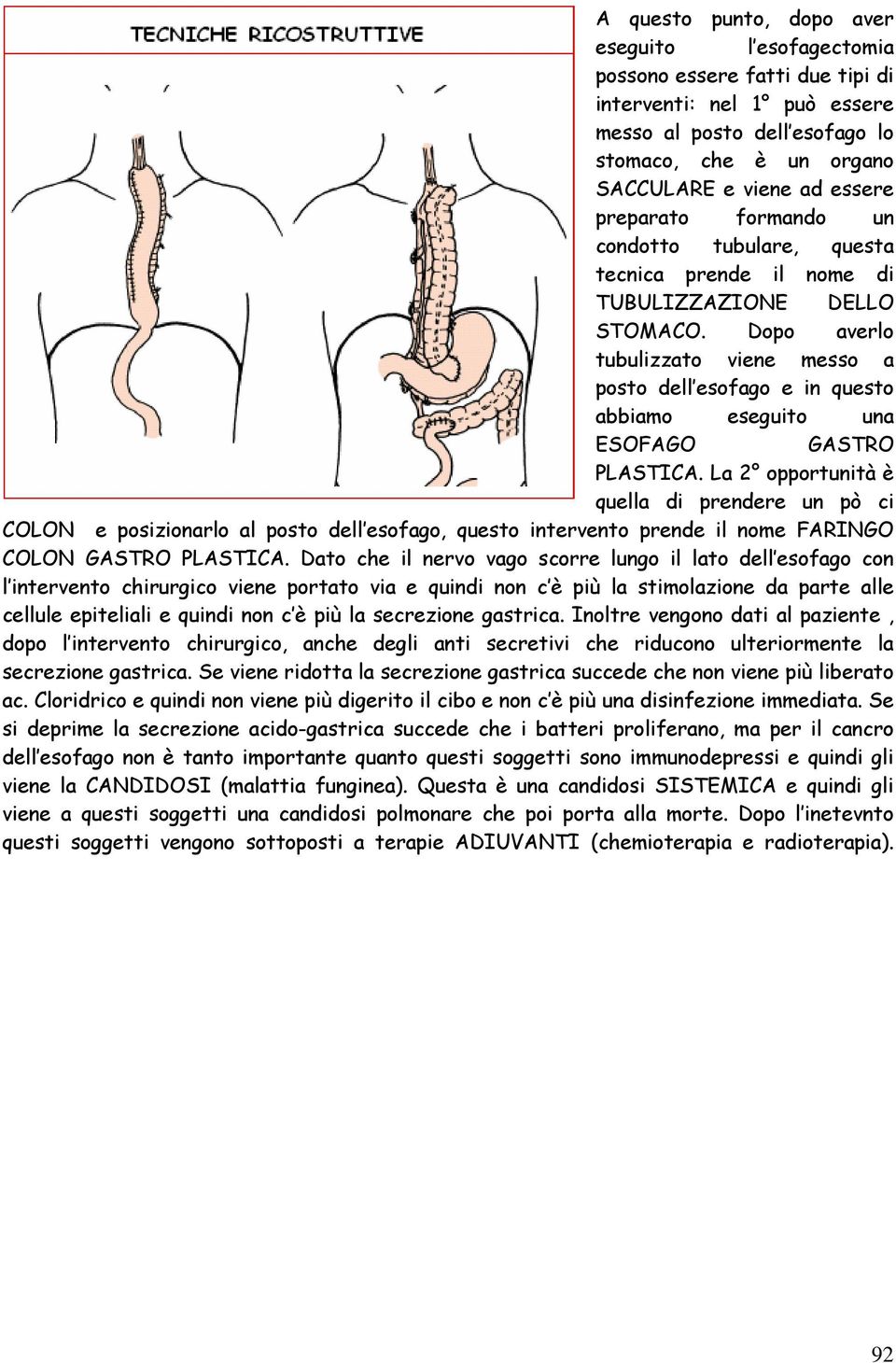 Dopo averlo tubulizzato viene messo a posto dell esofago e in questo abbiamo eseguito una ESOFAGO GASTRO PLASTICA.