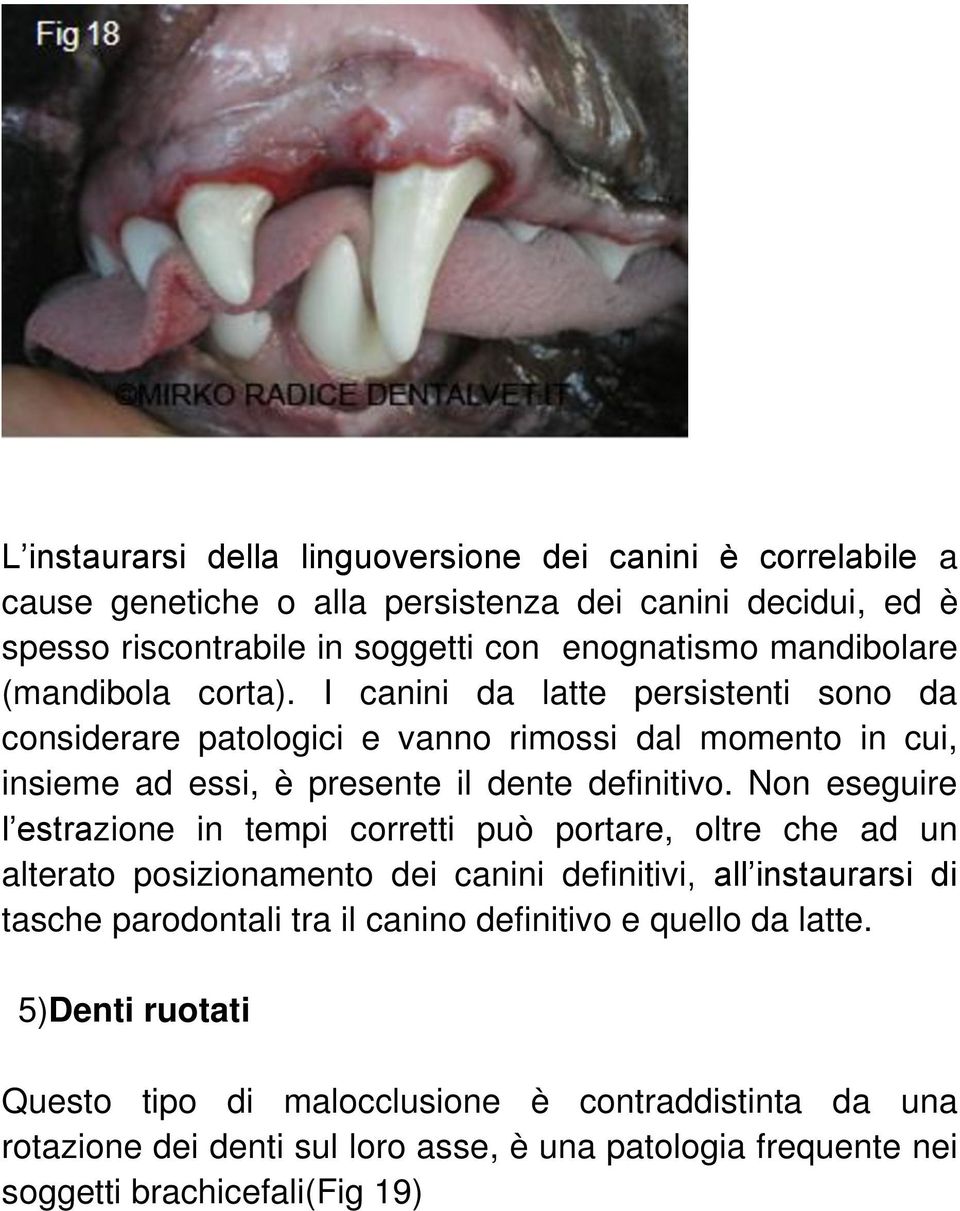 Non eseguire l estrazione in tempi corretti può portare, oltre che ad un alterato posizionamento dei canini definitivi, all instaurarsi di tasche parodontali tra il canino