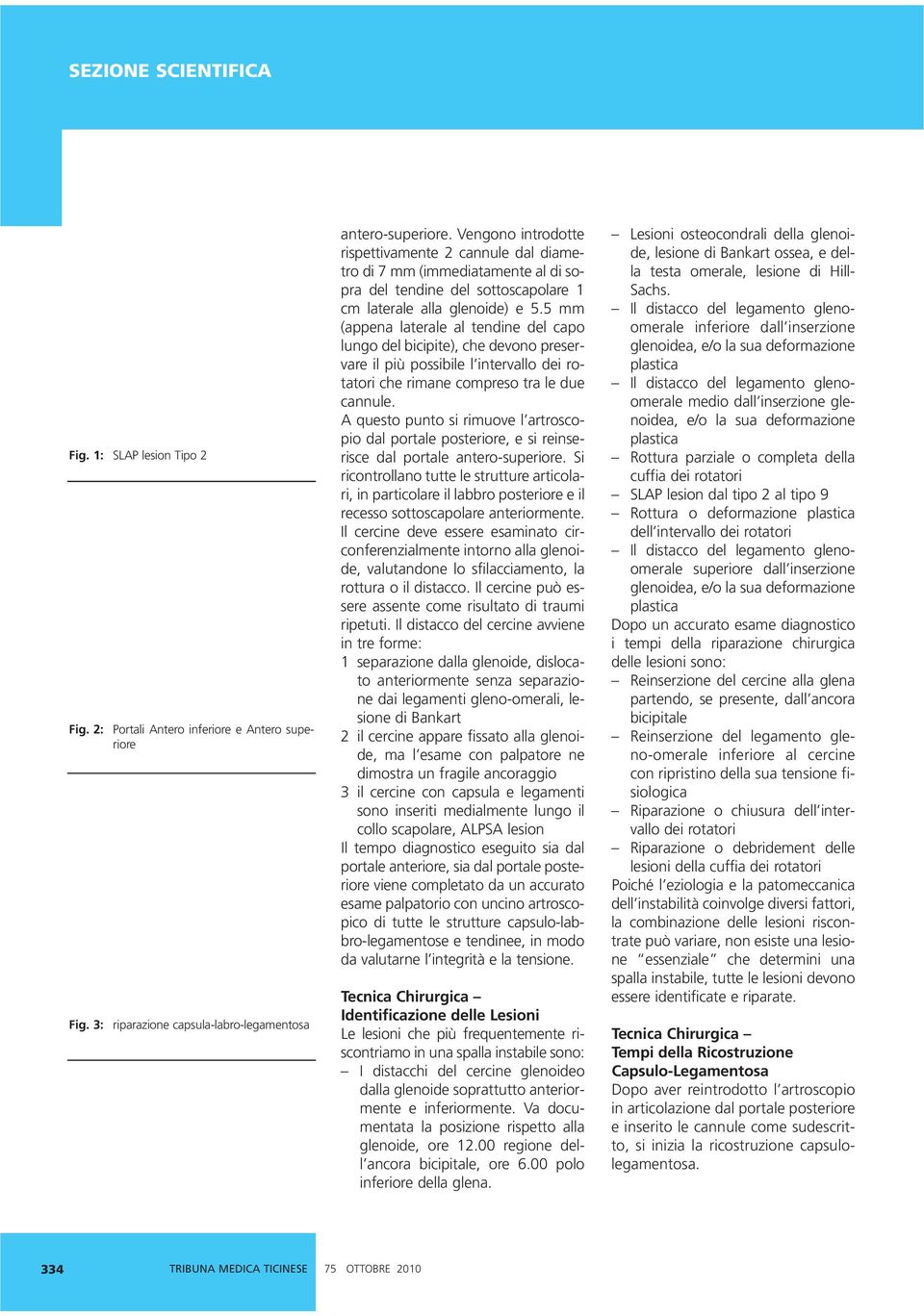 5 mm (appena laterale al tendine del capo lungo del bicipite), che devono preservare il più possibile l intervallo dei rotatori che rimane compreso tra le due cannule.