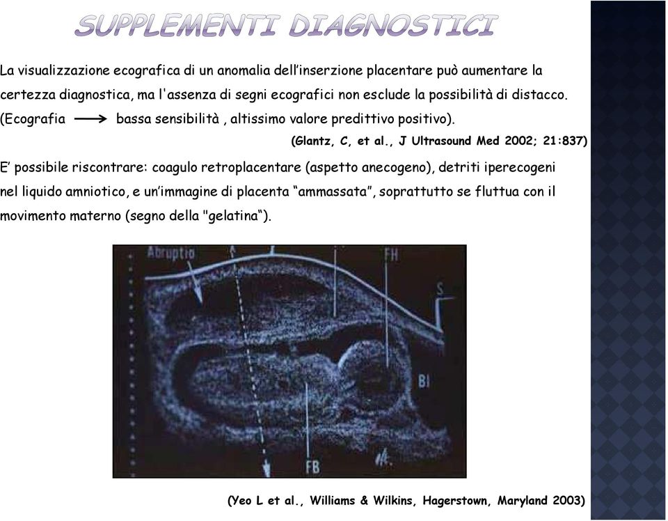 , J Ultrasound Med 2002; 21:837) E possibile riscontrare: coagulo retroplacentare (aspetto anecogeno), detriti iperecogeni nel liquido amniotico, e