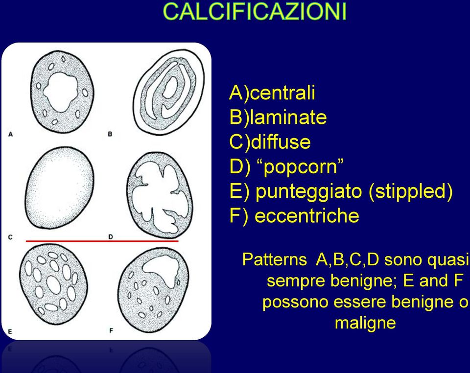 eccentriche Patterns A,B,C,D sono quasi