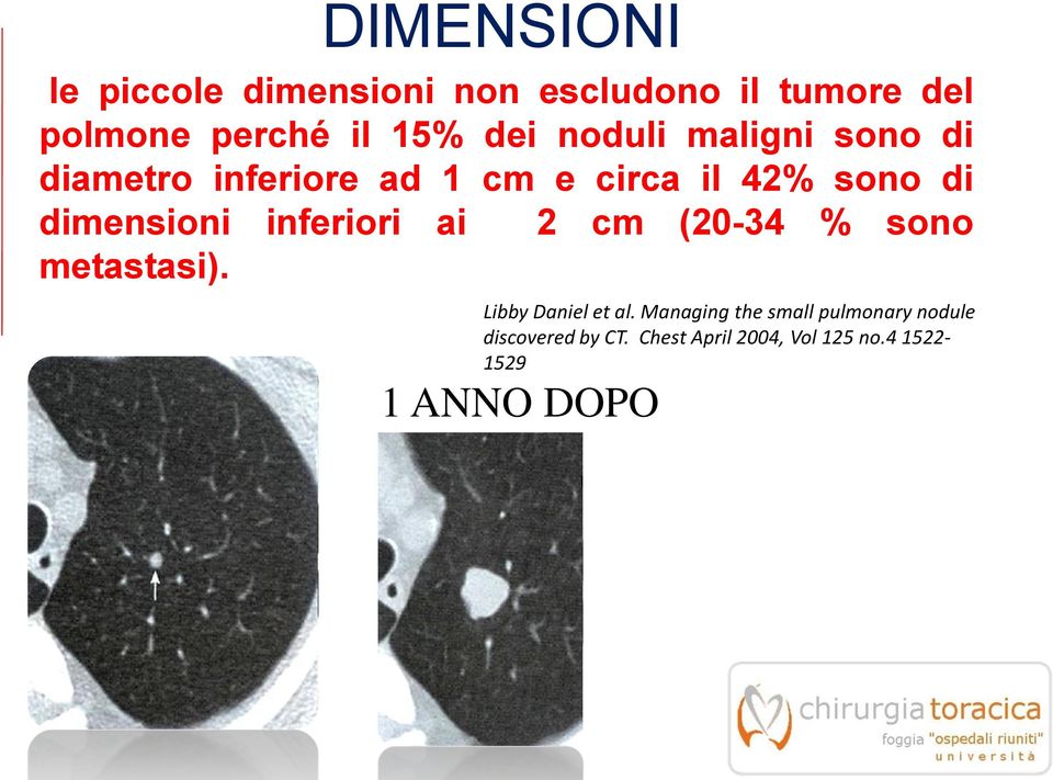 dimensioni inferiori ai 2 cm (20-34 % sono metastasi). Libby Daniel et al.