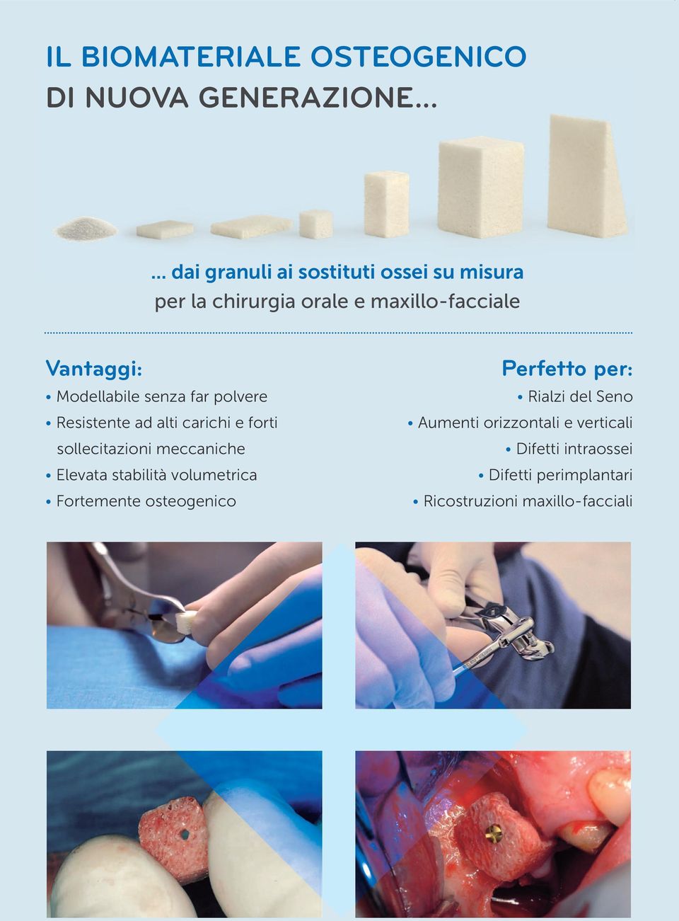 Modellabile senza far polvere Resistente ad alti carichi e forti sollecitazioni meccaniche Elevata